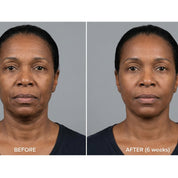 Sculpt + Define Advanced Neck and Decolletage Tightening Cream