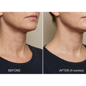 Sculpt + Define Advanced Neck and Decolletage Tightening Cream