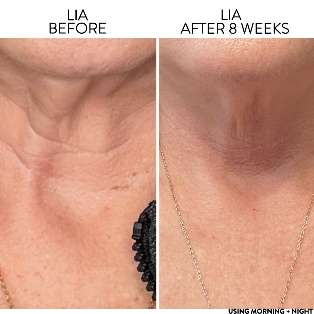 SCULPT_DEFINE_ADVANCED_NECK_CREAM_LIA_Before_After.jpg